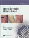 Cutaneous Manifestations of Rheumatic Diseases Cutaneous Manifestations of Rheumatic Diseases