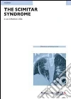 The scimitar syndrome The scimitar syndrome
